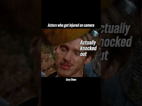 Actors who got injured on camera