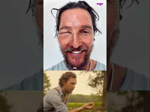 Matthew McConaughey's Eye Swelled Shut from Bee Sting! 😱🐝 #mathewmcconaughey #jimmyfallon
