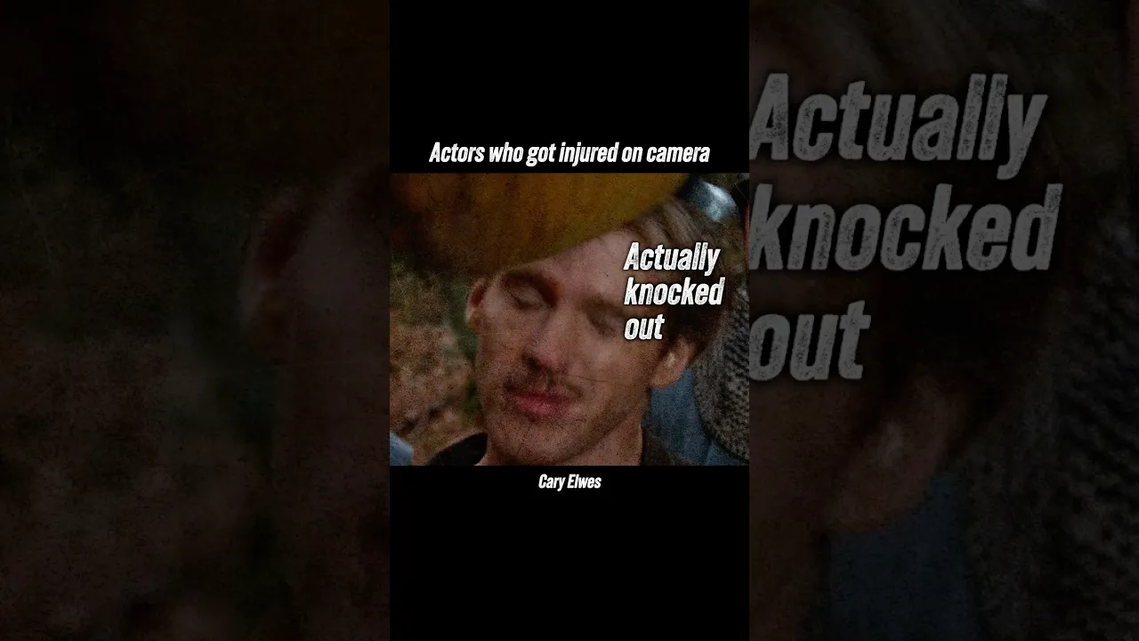 Actors who got injured on camera